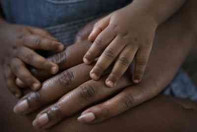 Comment Traiter les Fissures du bout des Doigts