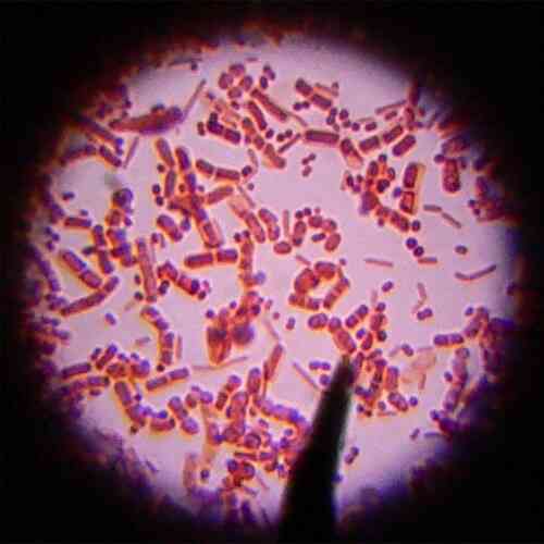 Quelles Sont Les Causes De Manger De La Chair Des Bactéries?