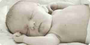 La correction de la ptose mammaire chez un nouveau-né bébé: correction de la chirurgie de l