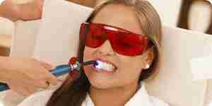 Blanchir les dents: le merlan, les méthodes et les traitements