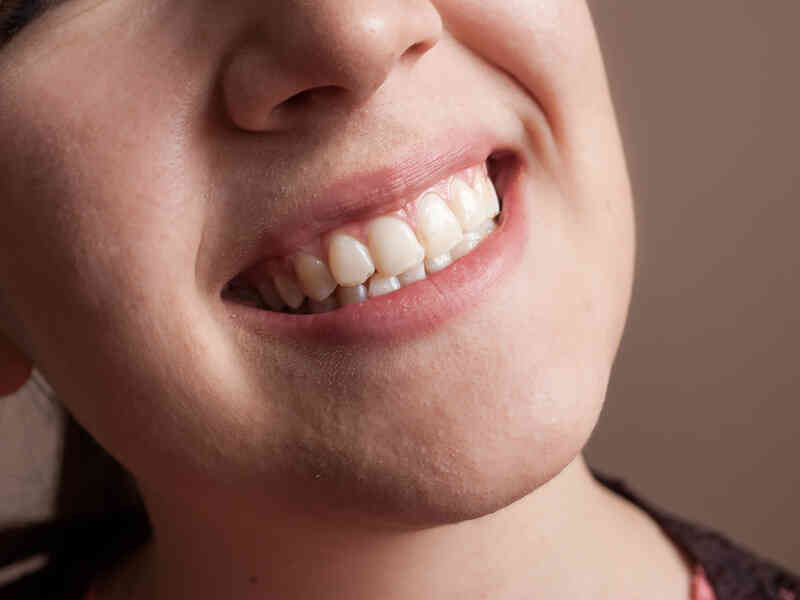 Comment Agir et de se vêtir Comme Emma Ross